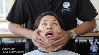 TMJ JAW DROPPING Compilation  Dr Rahim Chiropractic [upl. by Enirehtakyram]