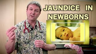 Jaundice in Newborns Pediatric Advice [upl. by Bethanne]