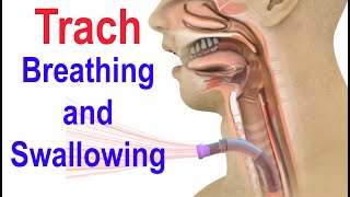 Trach Breathing and Swallowing [upl. by Pedro]