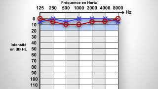 Audiogramme [upl. by Ayotahs815]