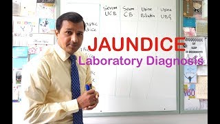 Jaundice  Laboratory Diagnosis [upl. by Reiko500]