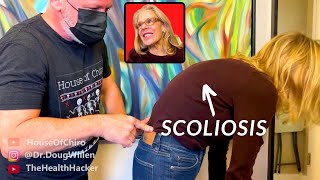 SCOLIOSIS  CHIROPRACTIC DELIVERS SOME RELIEF [upl. by Akimot]