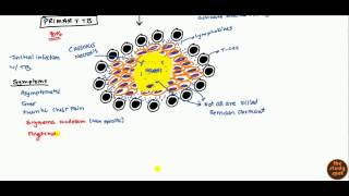 Tuberculosis for USMLE Step 1 and USMLE Step 2 [upl. by Gunilla272]