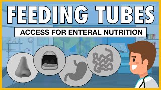 Types of Feeding Tubes EXPLAINED [upl. by Randolf]