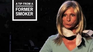 CDC Tips From Former Smokers  Terrie H’s Story [upl. by Uwton]