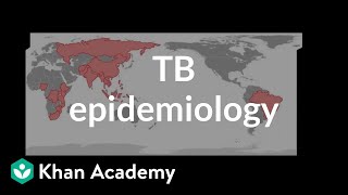 TB epidemiology  Infectious diseases  NCLEXRN  Khan Academy [upl. by Berte]