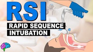 What is Rapid Sequence Intubation RSI [upl. by Naimed]