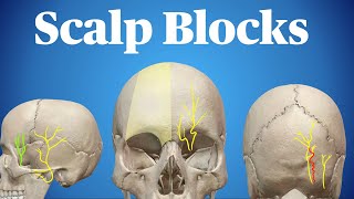 Scalp Blocks [upl. by Cordy]