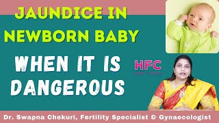 Jaundice In New Born Babies  Symptoms amp Treatment  Dr Swapna Chekuri  HFC [upl. by Leoj144]