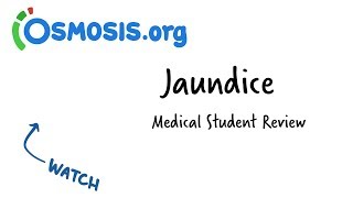 Jaundice  Clinical Presentation [upl. by Pournaras731]