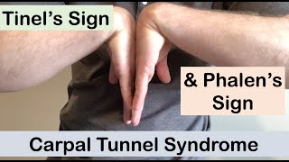 Carpal tunnel syndrome  Tinel’s sign and Phalen’s sign  Clinical Examination [upl. by Pam]