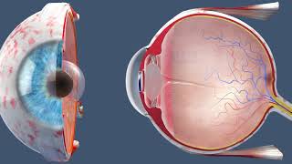 The Warning Signs of Cataracts [upl. by Asaph288]