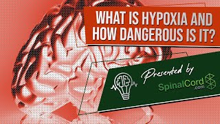 Hypoxia Diagnosis and Treatment Options [upl. by Odraboel140]