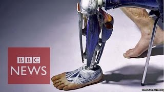 Prosthetics that speak from the soul [upl. by Kerrison]