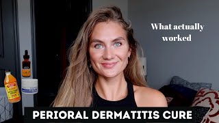 Perioral Dermatitis Treatment [upl. by Hsekin]