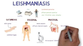 What is Leishmaniasis An introduction and overview [upl. by Sawyer]