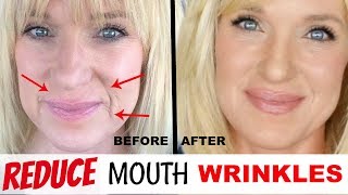 Get RID Of MOUTH WRINKLES WithOUT Fillers [upl. by Handler]