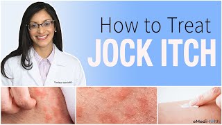 Jock Itch Treatment Prevention Causes and Home Care Tips [upl. by Moriarty856]