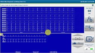 Welch Allyn® Diagnostic Cardiology Suite™ Resting ECG Workflow [upl. by Niarb585]