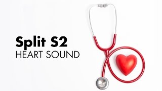 Fixed Split S2  Heart Sounds  MEDZCOOL [upl. by Aillicsirp]