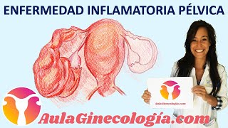 ENFERMEDAD INFLAMATORIA PÉLVICA EPI Síntomas y tratamiento  Ginecología y Obstetricia [upl. by Lindgren597]