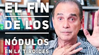 Episodio 1100 El fin de los nódulos en la tiroides [upl. by Gard654]