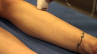 Epilator vs Waxing  Waxing Tips amp Tricks [upl. by Xer]