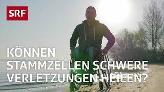 Stammzellen Ein Wundermittel der Medizin  Erklärvideo  SRF [upl. by Ferullo]