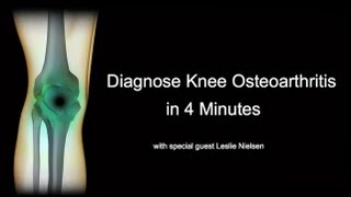 Diagnose Knee Osteoarthritis in 4 Minutes with Leslie Nielsen [upl. by Yelrebmik26]