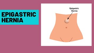 Lower Right Abdominal Pain During Pregnancy [upl. by Nerte993]