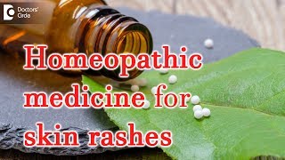 Homeopathic medicine for skin rashes  Dr Surekha Tiwari [upl. by Pam]