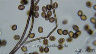 Toxic House Mold Under the Microscope [upl. by Aletse]