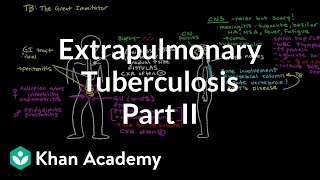 Extrapulmonary TB Part 2  Infectious diseases  NCLEXRN  Khan Academy [upl. by Eijneb]