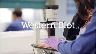 Western blot protocol video [upl. by Slrahc195]