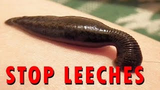 How to stop Leeches [upl. by Carothers584]