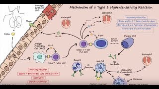 Type I Hypersensitivity  Mechanism Described Concisely [upl. by Yelrahs]