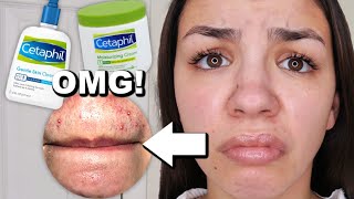 I Used Cetaphil Skincare For One Week [upl. by Jacquette]