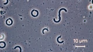 Spirilla bacteria seen through a compound microscope [upl. by Hcab]