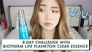 HOW I TRANSFORM MY SKIN IN 8 DAYS  BEFORE amp AFTER [upl. by Madora]