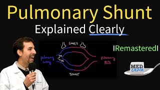 Shunting Explained Clearly Pulmonary Shunt  Remastered [upl. by Wallas]