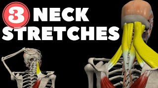 10 Best Stiff Neck Pain Relief Stretches [upl. by Merrile]