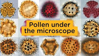 Pollen under the microscope [upl. by Eelyr298]