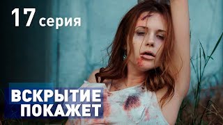 ВСКРЫТИЕ ПОКАЖЕТ СЕРИЯ 17 2019 ГОД [upl. by Balcke]