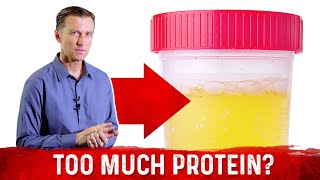 Top 5 Symptoms Of Eating Too Much Protein – DrBerg [upl. by Antony]