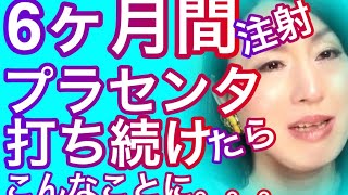 【元男子激白】半年間プラセンタ注射を打ち続けて体に起きた異変を告白。。。 [upl. by Ocsecnarf]