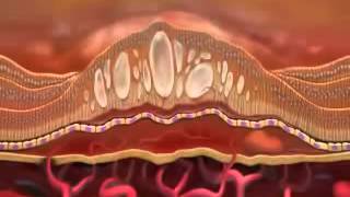 Lucentis ranibizumab [upl. by Kone]