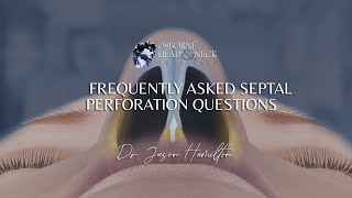 Septal Perforation Frequently Asked Questions by Dr Jason S Hamilton [upl. by Ellehcear498]