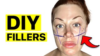 DIY Cheek Filler How I Did Cheek Filler At Home  Surgeon Reacts [upl. by Doubler372]