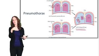 ERV amp HRV Units Explained [upl. by Elaina]