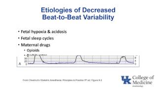 Antepartum fetal surveillance [upl. by Margaretta]